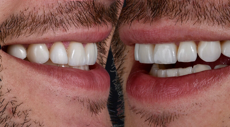 after 02 - Floss Lincoln Park