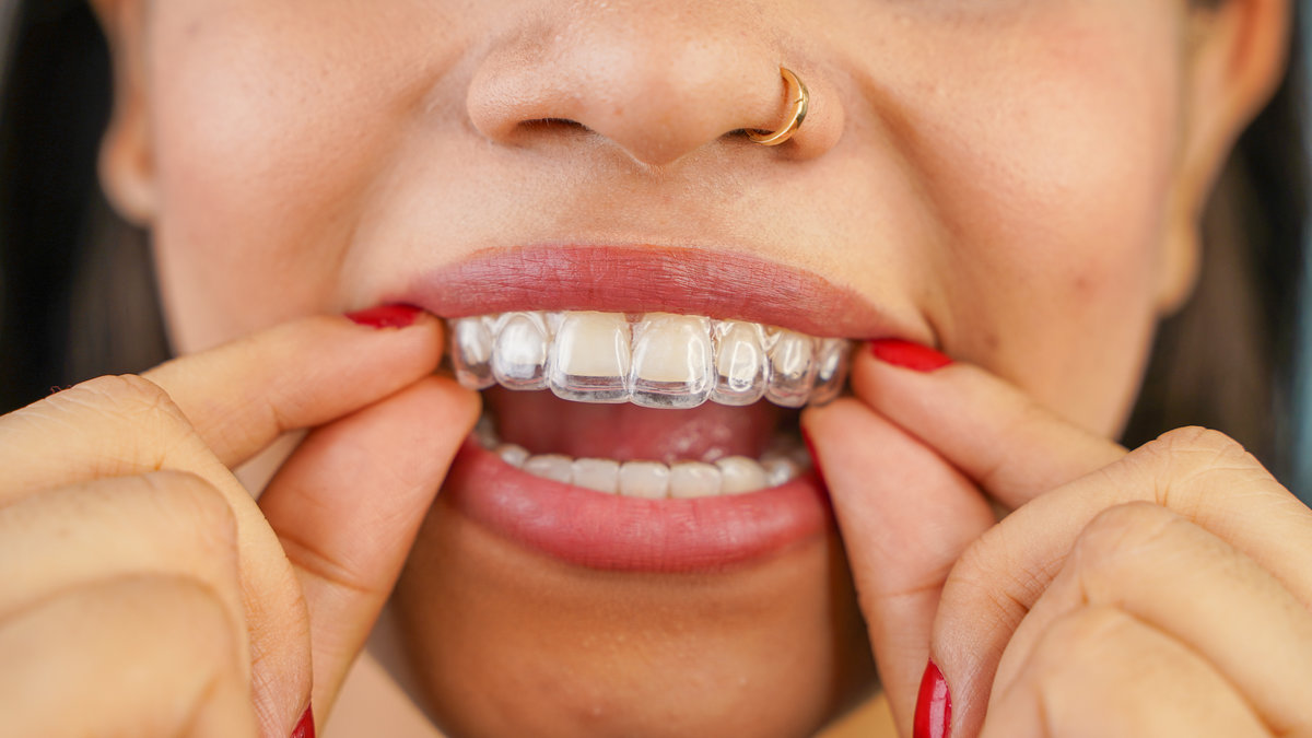 Young Asian Indian woman holding removable invisible aligner, also known as invisalign or clear aligner